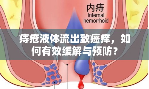 痔瘡液體流出致瘙癢，如何有效緩解與預防？