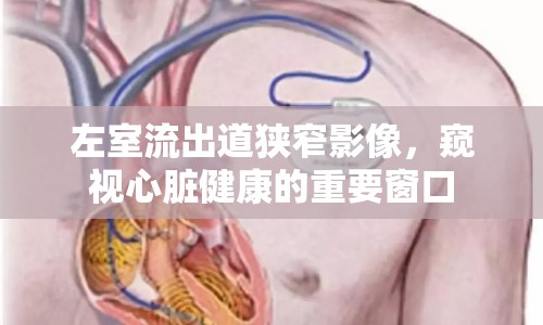 左室流出道狹窄影像，窺視心臟健康的重要窗口