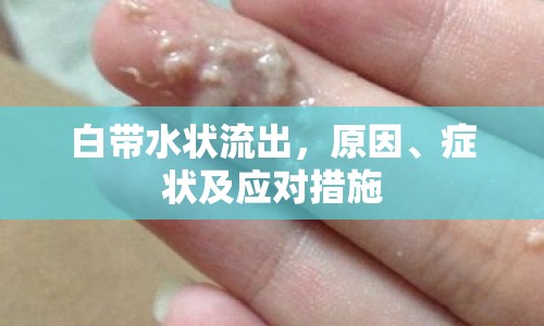 白帶水狀流出，原因、癥狀及應(yīng)對措施