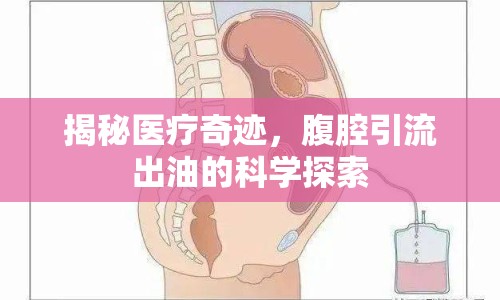 揭秘醫(yī)療奇跡，腹腔引流出油的科學(xué)探索