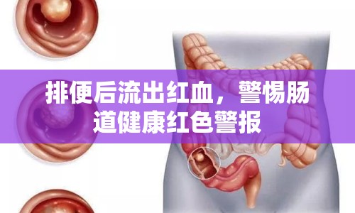 排便后流出紅血，警惕腸道健康紅色警報