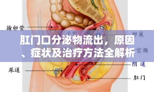 肛門口分泌物流出，原因、癥狀及治療方法全解析