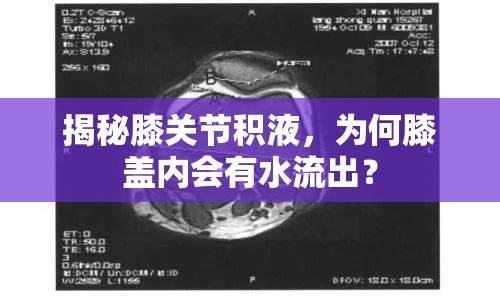 揭秘膝關(guān)節(jié)積液，為何膝蓋內(nèi)會有水流出？