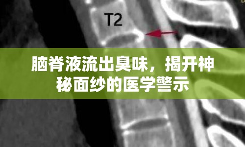腦脊液流出臭味，揭開(kāi)神秘面紗的醫(yī)學(xué)警示