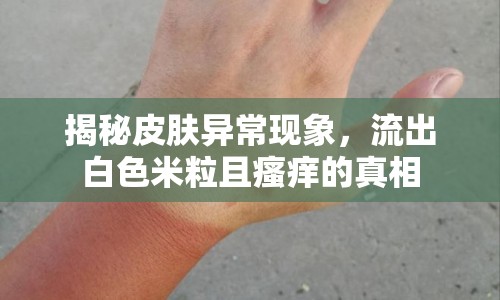 揭秘皮膚異常現象，流出白色米粒且瘙癢的真相