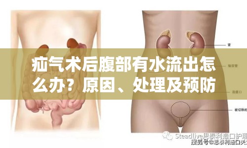 疝氣術(shù)后腹部有水流出怎么辦？原因、處理及預(yù)防措施全解析