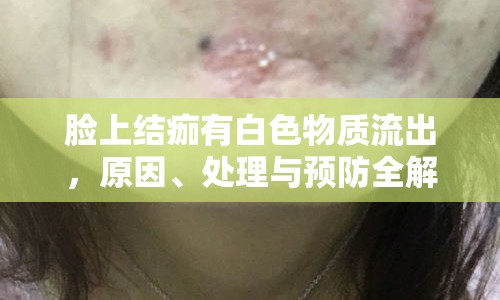 臉上結(jié)痂有白色物質(zhì)流出，原因、處理與預(yù)防全解析