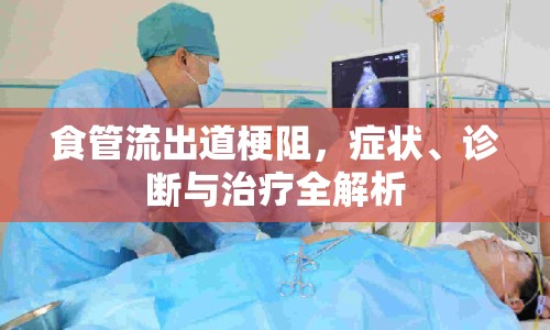 食管流出道梗阻，癥狀、診斷與治療全解析