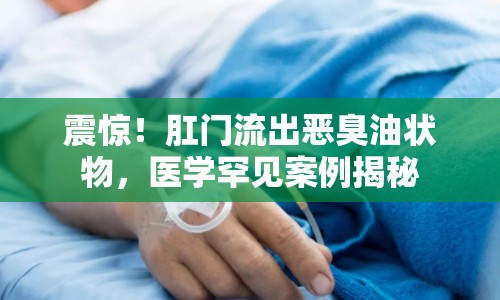 震驚！肛門流出惡臭油狀物，醫(yī)學(xué)罕見案例揭秘