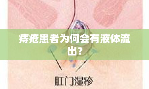 痔瘡患者為何會(huì)有液體流出？