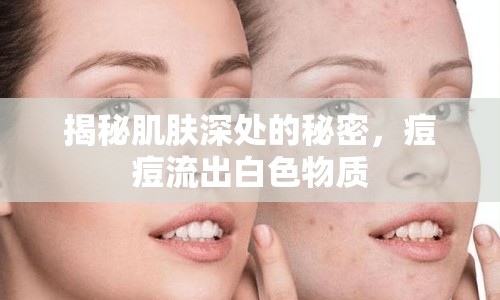 揭秘肌膚深處的秘密，痘痘流出白色物質(zhì)