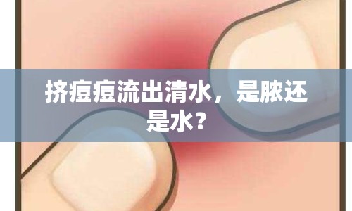 擠痘痘流出清水，是膿還是水？