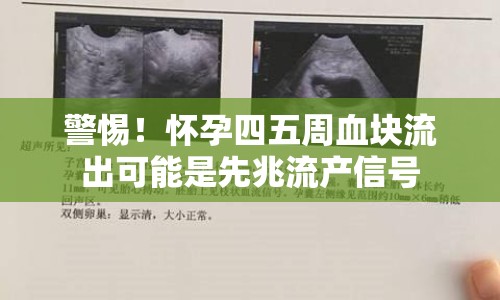 警惕！懷孕四五周血塊流出可能是先兆流產(chǎn)信號(hào)