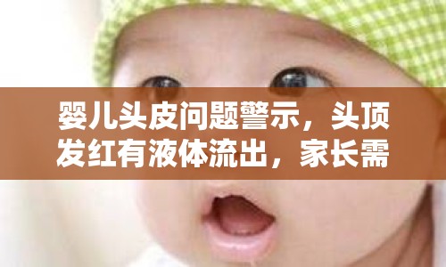 嬰兒頭皮問題警示，頭頂發(fā)紅有液體流出，家長需警惕！