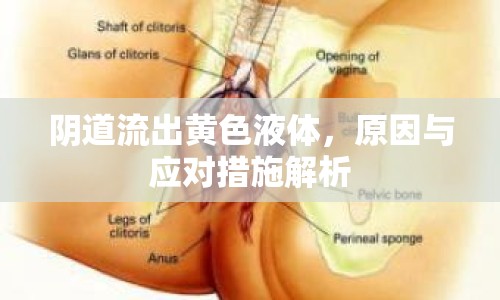陰道流出黃色液體，原因與應(yīng)對(duì)措施解析