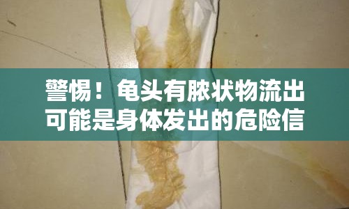 警惕！龜頭有膿狀物流出可能是身體發(fā)出的危險信號