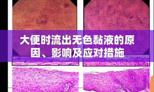 大便時(shí)流出無色黏液的原因、影響及應(yīng)對措施