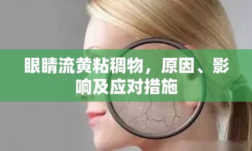 眼睛流黃粘稠物，原因、影響及應(yīng)對(duì)措施