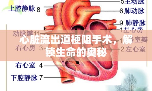 心臟流出道梗阻手術(shù)，解鎖生命的奧秘