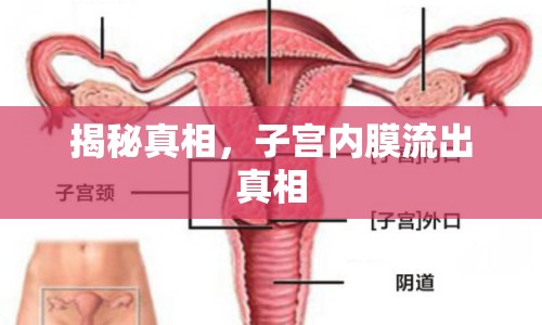 揭秘真相，子宮內(nèi)膜流出真相