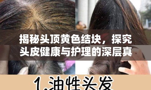 揭秘頭頂黃色結(jié)塊，探究頭皮健康與護(hù)理的深層真相