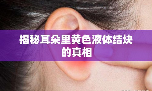 揭秘耳朵里黃色液體結(jié)塊的真相