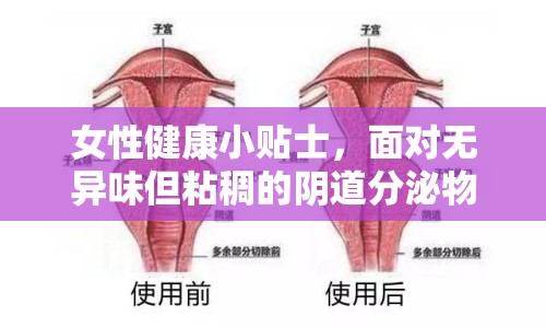 女性健康小貼士，面對(duì)無異味但粘稠的陰道分泌物，你需要了解的真相