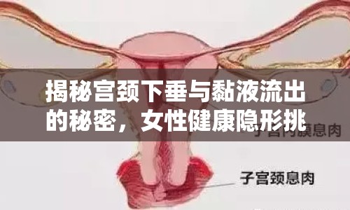 揭秘宮頸下垂與黏液流出的秘密，女性健康隱形挑戰(zhàn)的深度解析
