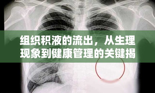 組織積液的流出，從生理現(xiàn)象到健康管理的關(guān)鍵揭秘