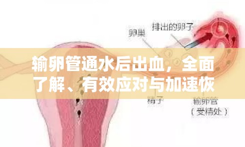 輸卵管通水后出血，全面了解、有效應(yīng)對(duì)與加速恢復(fù)的溫馨指南