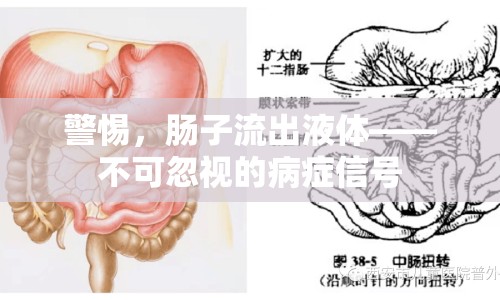 警惕，腸子流出液體——不可忽視的病癥信號(hào)