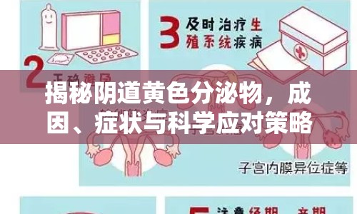 揭秘陰道黃色分泌物，成因、癥狀與科學(xué)應(yīng)對(duì)策略