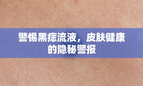 警惕黑痣流液，皮膚健康的隱秘警報