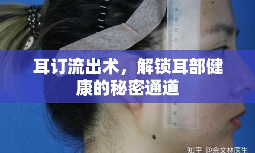 耳訂流出術(shù)，解鎖耳部健康的秘密通道
