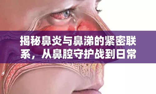 揭秘鼻炎與鼻涕的緊密聯(lián)系，從鼻腔守護戰(zhàn)到日常護理指南