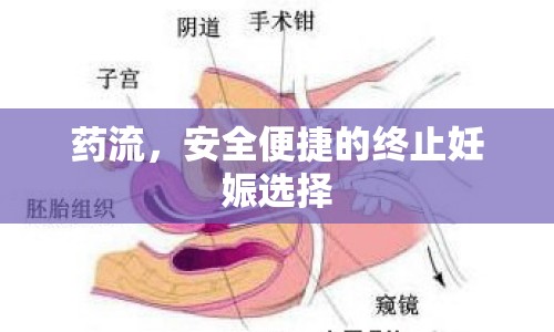 藥流，安全便捷的終止妊娠選擇