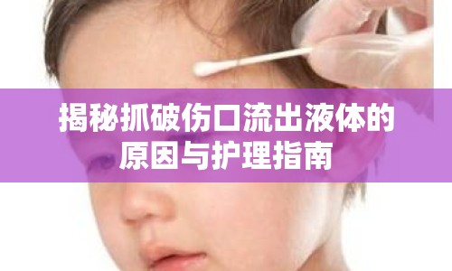 揭秘抓破傷口流出液體的原因與護理指南