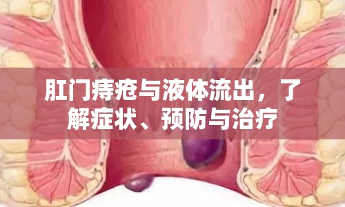 肛門(mén)痔瘡與液體流出，了解癥狀、預(yù)防與治療