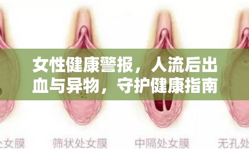女性健康警報，人流后出血與異物，守護健康指南
