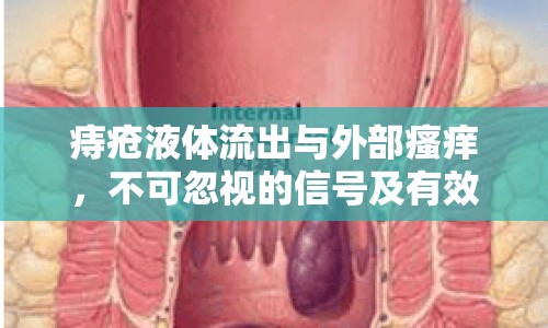 痔瘡液體流出與外部瘙癢，不可忽視的信號及有效應對策略