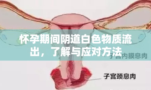 懷孕期間陰道白色物質(zhì)流出，了解與應(yīng)對方法