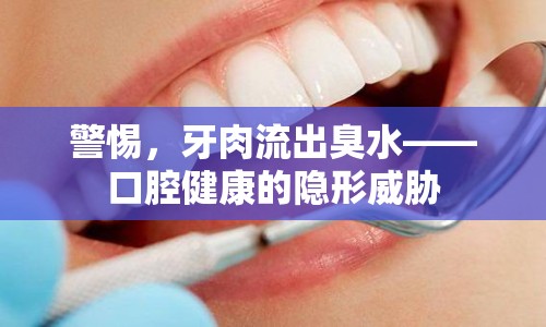 警惕，牙肉流出臭水——口腔健康的隱形威脅
