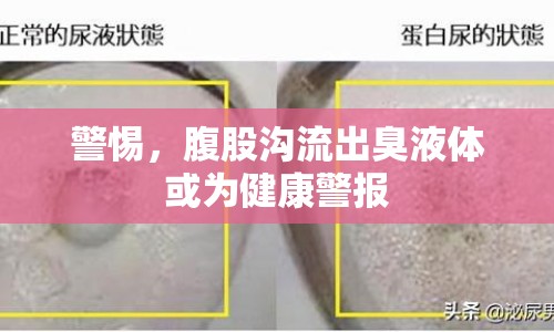 警惕，腹股溝流出臭液體或為健康警報