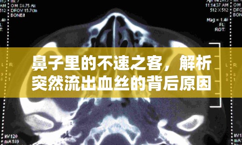 鼻子里的不速之客，解析突然流出血絲的背后原因