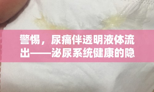 警惕，尿痛伴透明液體流出——泌尿系統(tǒng)健康的隱形警報