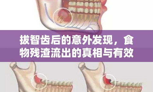 拔智齒后的意外發(fā)現，食物殘渣流出的真相與有效應對策略