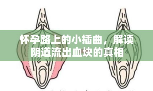 懷孕路上的小插曲，解讀陰道流出血塊的真相