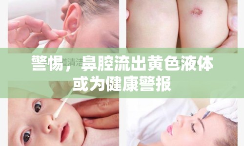 警惕，鼻腔流出黃色液體或為健康警報