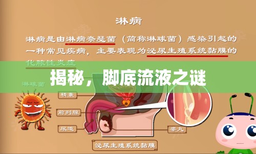 揭秘，腳底流液之謎