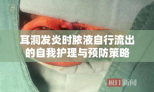 耳洞發(fā)炎時(shí)膿液自行流出的自我護(hù)理與預(yù)防策略